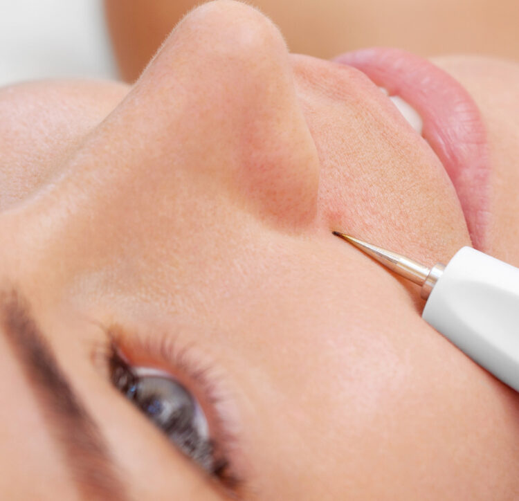 Botox® - Arizona Desert Dermatology and Surgery
